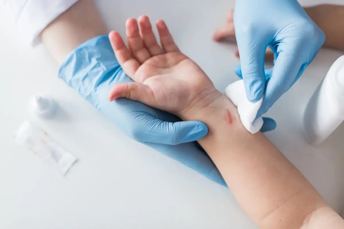 Thrombocytopenia: Crucial Bleeding Risk Level